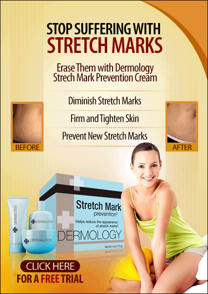 Buy Dermology Stretch Mark Cream