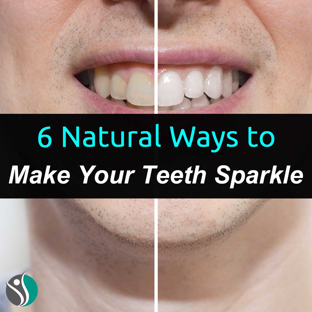 6 Natural Ways to Make Your Teeth Sparkle